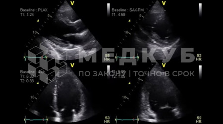Аппарат УЗИ (сканер) GE Healthcare Vivid T8 medcub