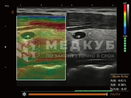 Аппарат УЗИ (сканер) Chison SonoTouch 80 Expert medcub