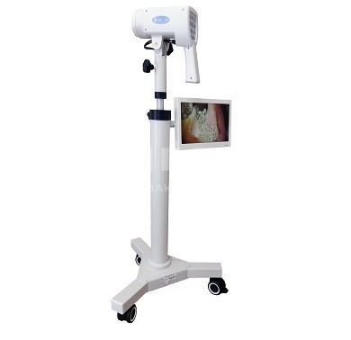 Компактный видеокольпоскоп UAB Biomedicinos Technika ALScope SLV-101 HDM на прямой стойке medcub