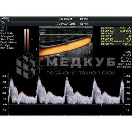 Аппарат УЗИ (сканер) GE Healthcare Voluson P8 medcub