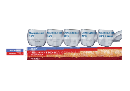 Аппарат RF-лифтинга BTL EXILIS Ultra 360 medcub