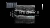 Аппарат УЗИ (сканер) GE Healthcare Vivid T8 medcub