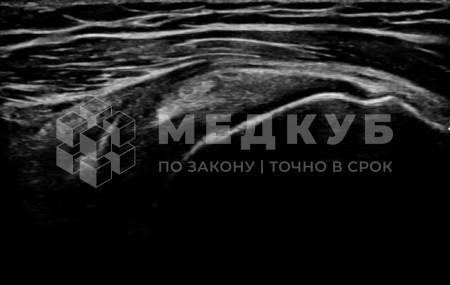 Аппарат УЗИ НПО Сканер РуСкан 65 medcub