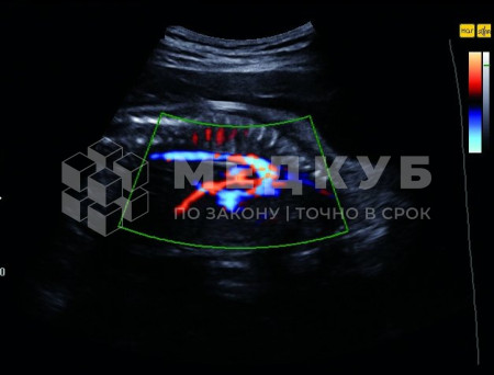 УЗИ-аппарат портативный НПО Сканер РуСкан 70П medcub