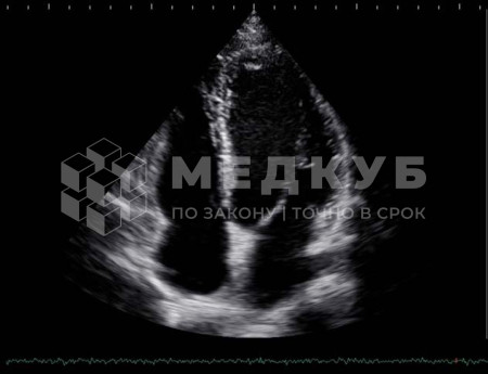 Аппарат УЗИ НПО Сканер РуСкан 65М medcub