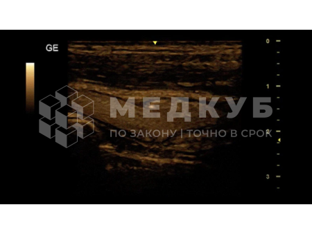 Аппарат УЗИ (сканер) GE Healthcare Versana Essential medcub