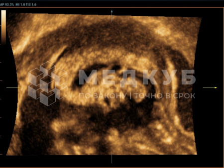 Аппарат УЗИ (сканер) Mindray Resona 7s medcub