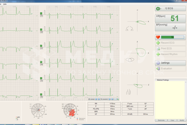 Электрокардиограф (ЭКГ) BTL FLEXI 12 с возможностью подключения к системе BTL CardioPoint ECG C600 medcub