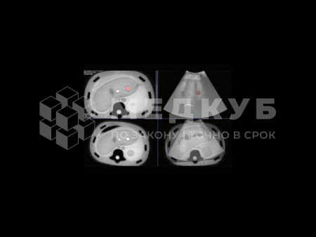 Аппарат УЗИ (сканер) Chison Qbit 12 medcub