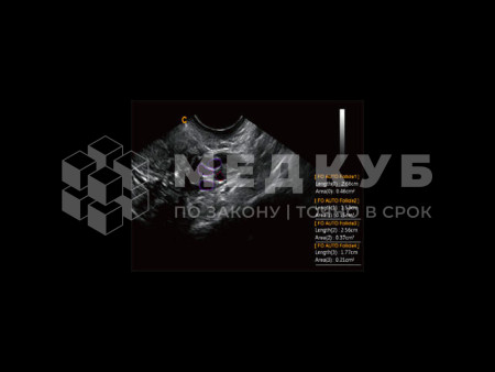 Аппарат УЗИ (сканер) Chison Qbit 12 medcub