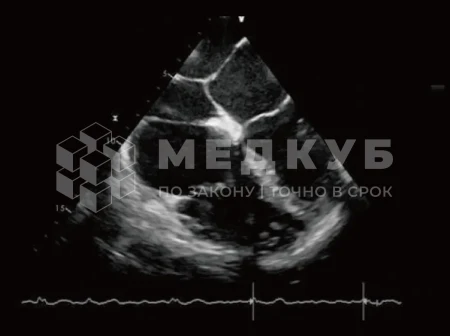 Аппарат УЗИ (сканер) Chison SonoTouch 80 Expert medcub