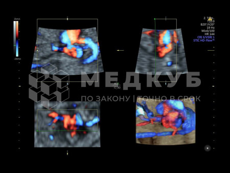 Аппарат УЗИ (сканер) GE Healthcare Voluson E10 medcub