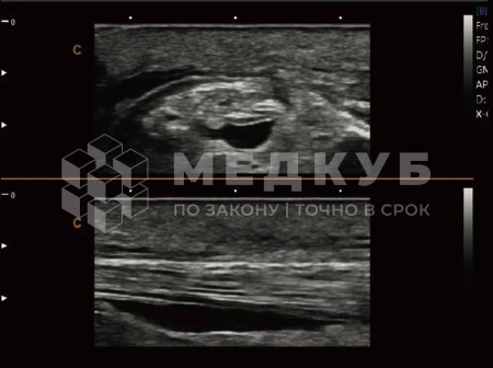 Аппарат УЗИ (сканер) Chison SonoTouch 80 Expert medcub