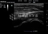 Портативный аппарат УЗИ Mindray TE7 (планшет) medcub