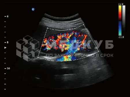 Аппарат УЗИ (сканер) Chison Qbit 3 medcub