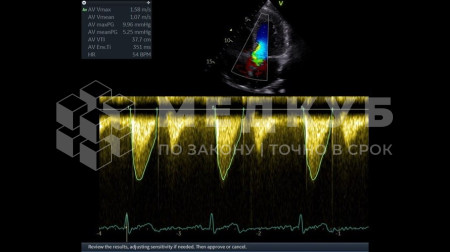 Аппарат УЗИ (сканер) GE Healthcare Vivid T8 medcub
