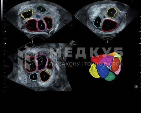 Аппарат УЗИ (сканер) GE Healthcare Voluson S8 medcub