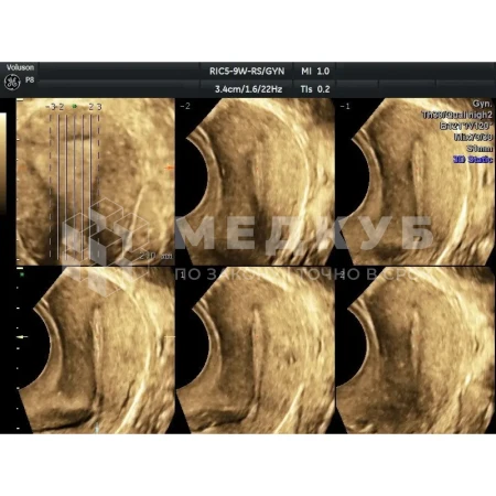 Аппарат УЗИ (сканер) GE Healthcare Voluson P8 medcub
