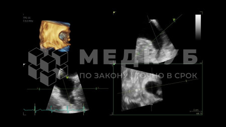 Аппарат УЗИ (сканер) GE Healthcare Vivid S70N medcub