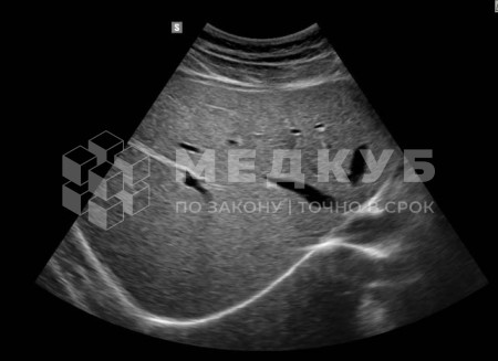 Аппарат УЗИ НПО Сканер РуСкан 65М medcub